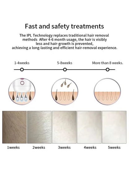 Mini Laser Hair Removal SKU: MLH-N-GF-ZAM